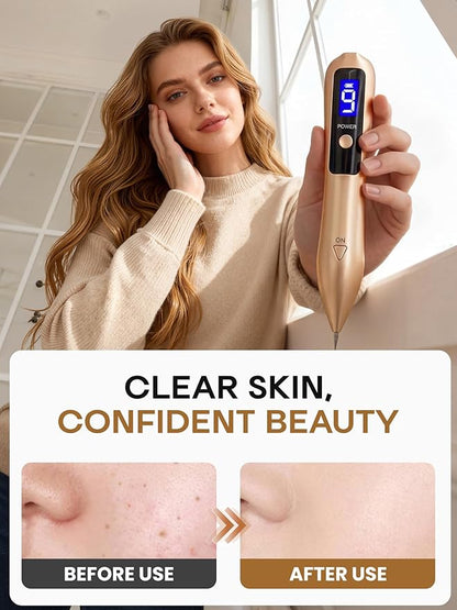Mole Wart Removal Tool